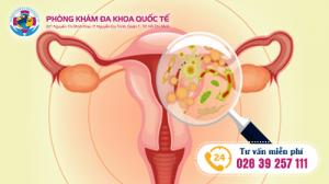 biện pháp khắc phục viêm âm đạo ở phụ nữ hiệu quả nhất